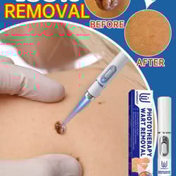 professional skin treatment device
