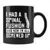 MR-1462023114042-back-surgery-mug-back-surgery-gift-spine-surgery-mug-scoliosis-image-1.jpg