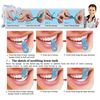 Nano Teeth Whitening Kit (2).jpg