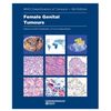 Female Genital Tumours.jpg