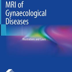 "mri of gynaecological diseases: illustrations and cases (zhang) 1 ed (2023)" pdf book