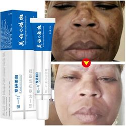 whitening freckle cream effective remove melasma dark spots cream fade melanin moisturize brighten smooth beauty face sk