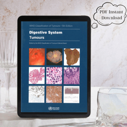 digestive system tumours: who classification of tumours, e-books, pdf instant download