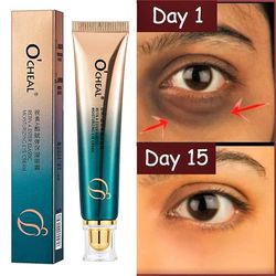 eye bags anti-aging firming eye serum eye care cream, anti wrinkle eye cream,  anti-dark circles remover