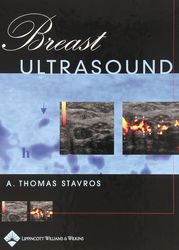 breast ultrasound 1st edition