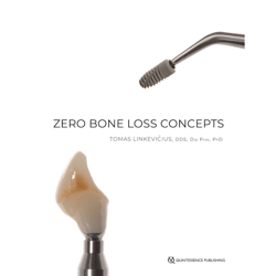 zero bone loss concepts 1st edition