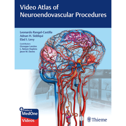 video atlas of neuroendovascular procedures 1st edition