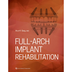 full-arch implant rehabilitation 1st edition