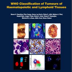 who classification of tumours of haematopoietic and lymphoid tissues