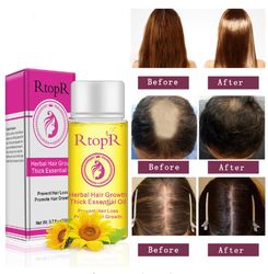 fast powerful hair growth products essential oil liquid treatment preventing hair loss hair care 20ml
