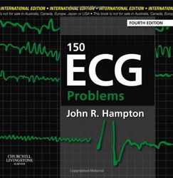 150 ecg problems 4 pdf instant download