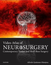 video atlas of neurosurgery: contemporary tumor and skull base surgery 1st edition pdf instant download
