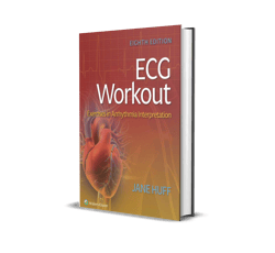 ecg workout-exercises in arrhythmia interpretation 8 edition