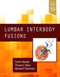 lumbar interbody fusions 1st pdf instant download