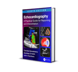 echocardiography a practical guide for reporting and interpretation