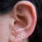 nonpiercingacupressureearringsforweightloss2 (1).png