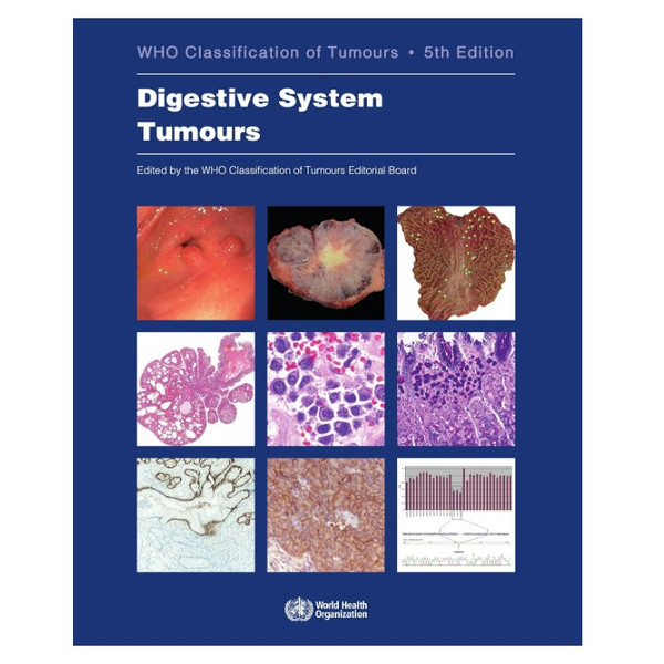 Digestive System Tumours.jpg