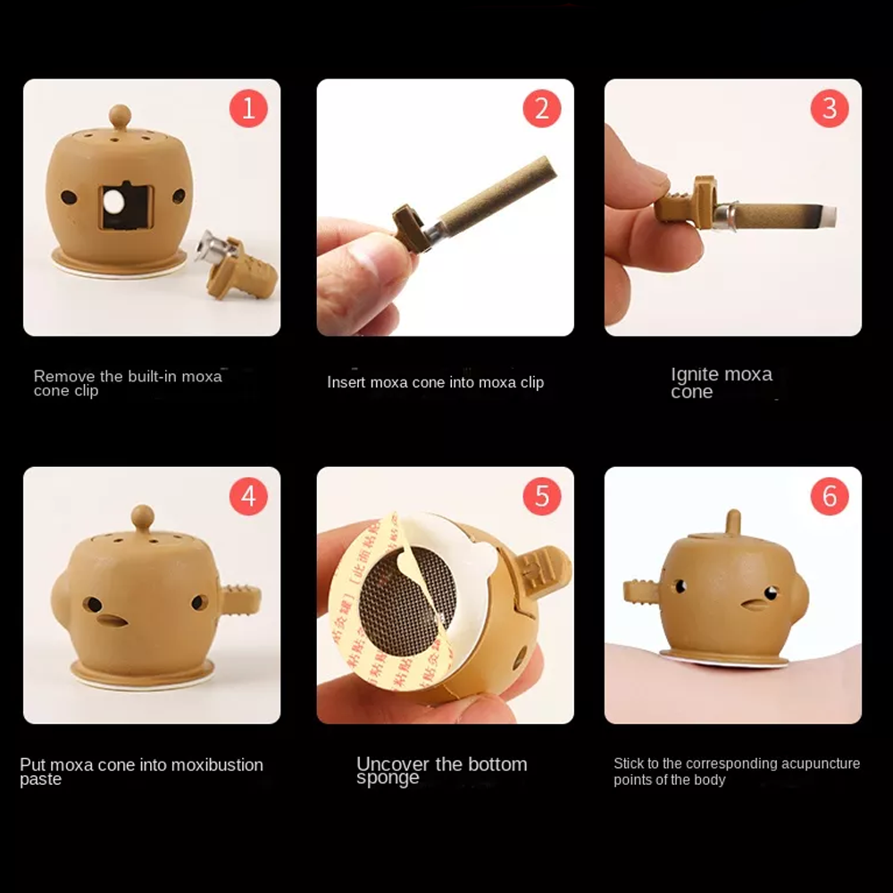 Using Moxa Cupping Therapy on Back for Detoxification