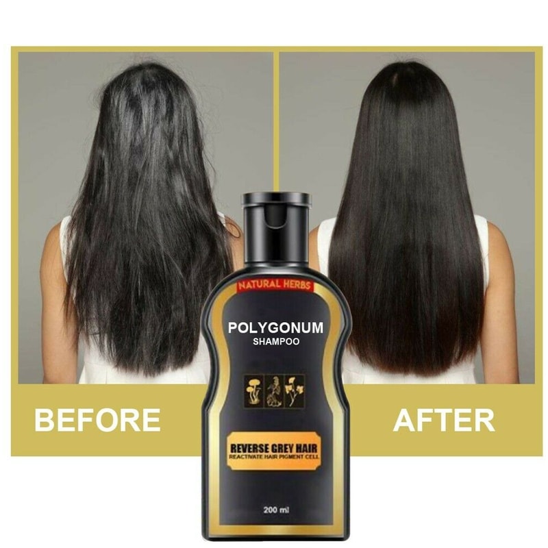 greyreversehairdarkeningshampoo4.png