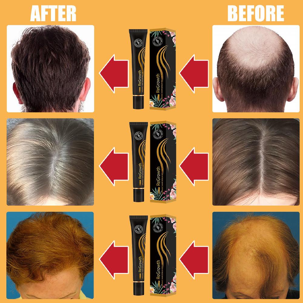 regrowthorganichairserumroller7png