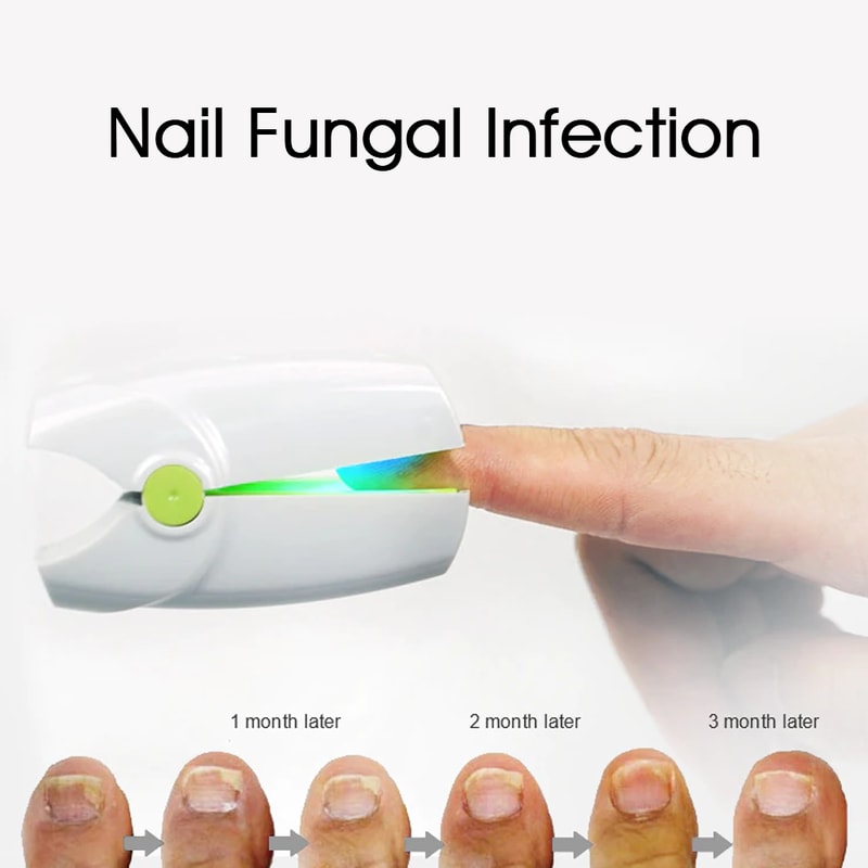 ledlightfornailfungustreatment8.png