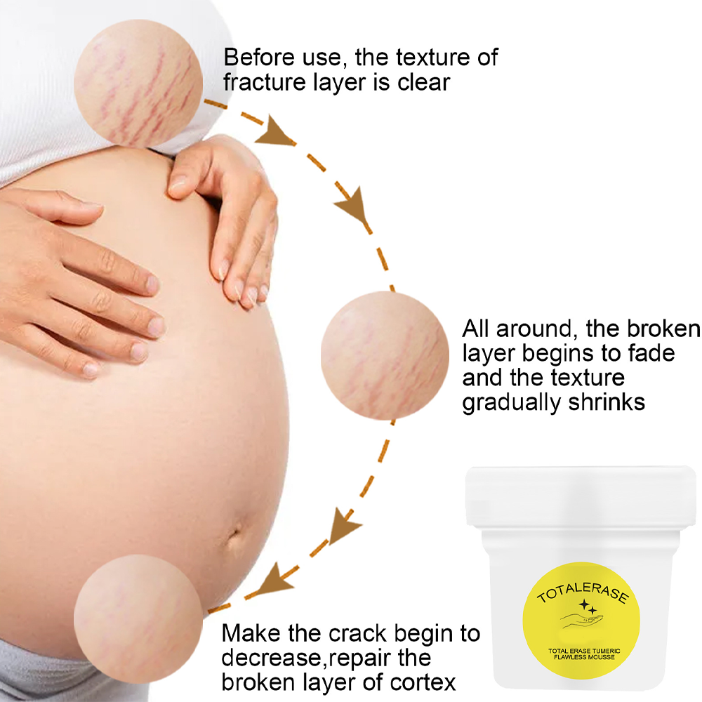 erasetotalturmericflawlessmousse3.png