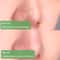 antiacneblackheadremovergreenteamask4.png