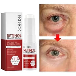 under eye bag removal cream for dark circles, puffiness & tired looking eyes
