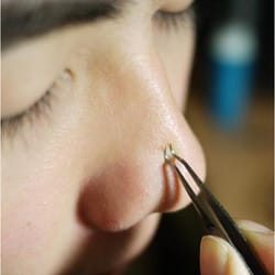 blackhead and comedone acne extractor kit (3 pieces)