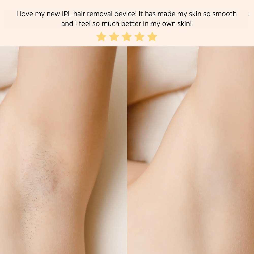 IPL Laser Hair Removal Handset System Painless And Safe For All Skin Types Perfect For Home Use 5