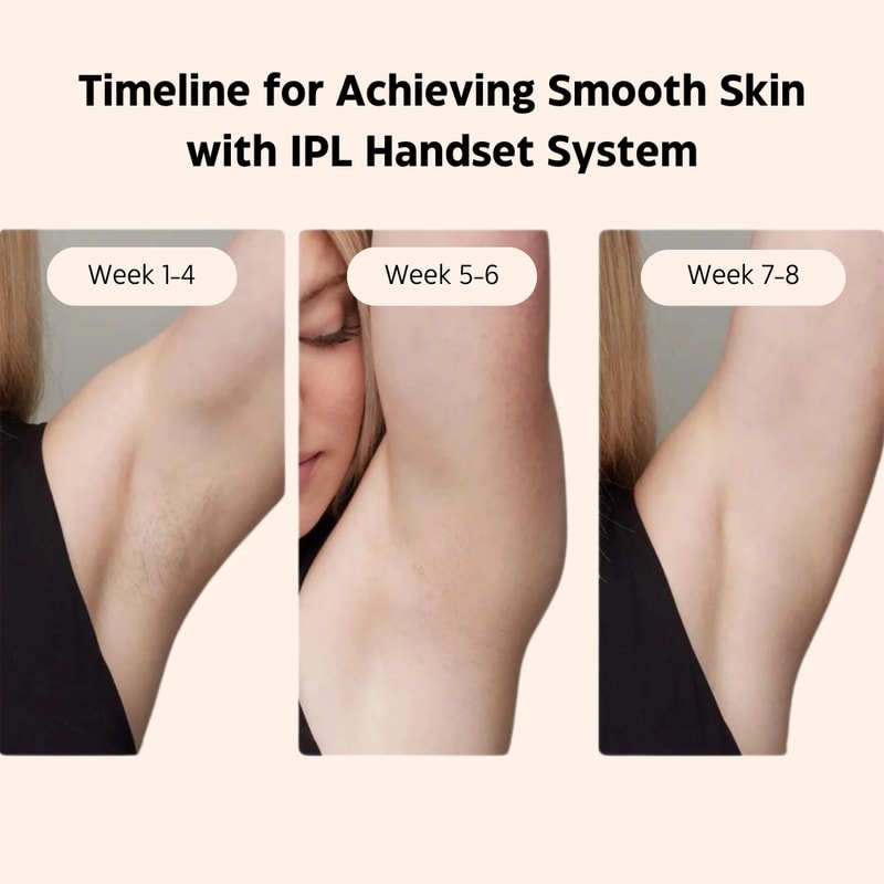 IPL Laser Hair Removal Handset System Painless And Safe For All Skin Types Perfect For Home Use 4