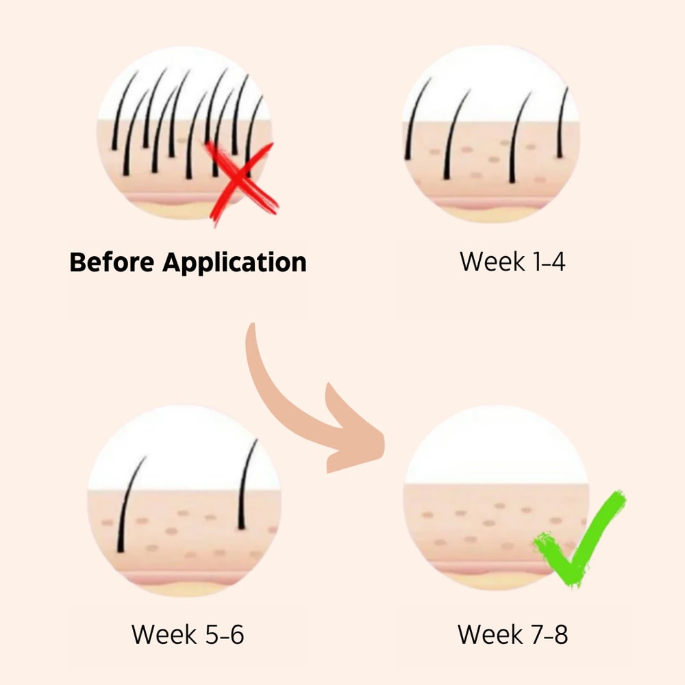 IPL Laser Hair Removal Handset System Painless And Safe For All Skin Types Perfect For Home Use 6