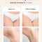 Hair Removal Laser With Unlimited IGBT Fast Flashes Painless Body Epilator For Bikini Armpit Face 2