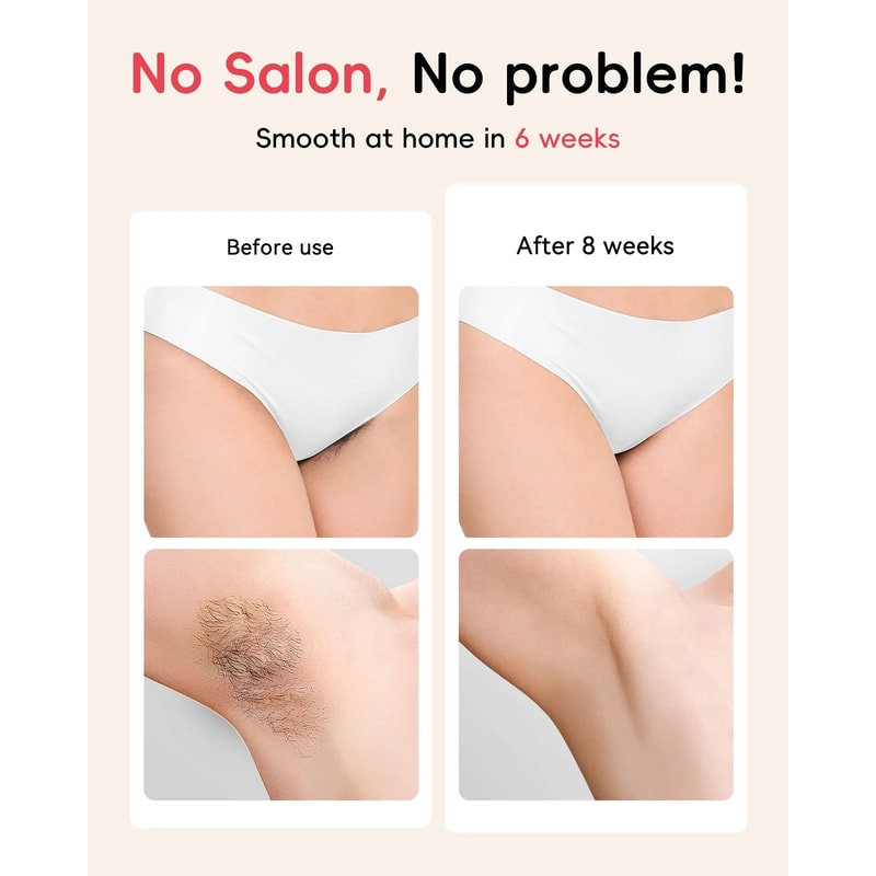 Hair Removal Laser With Unlimited IGBT Fast Flashes Painless Body Epilator For Bikini Armpit Face 2