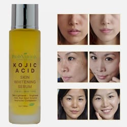 kojic acid skin whitening lightening brightening serum bleaching spot fade cream