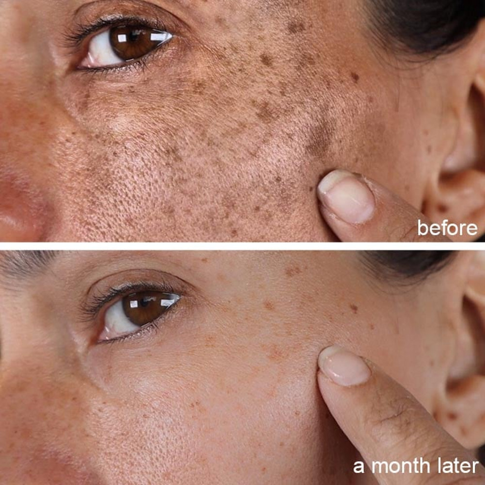 Melanin Correcting Essential Oil 3