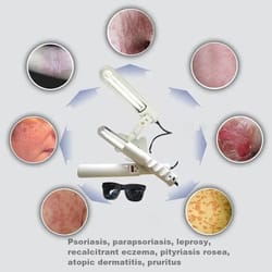 uv 311nm ultraviolet phototherapy device uses philips lamp uvb to treat vitiligo, psoriasis, white spots, skin diseases