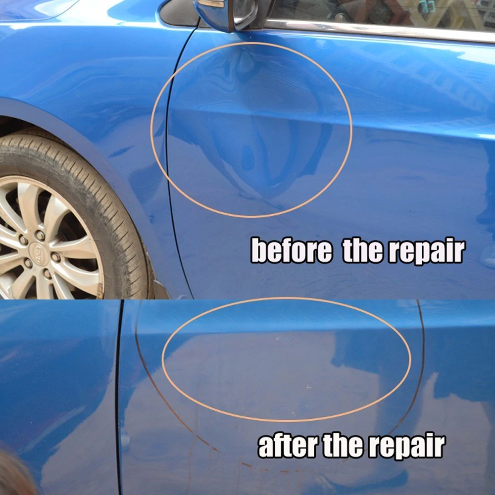 dent removal kit