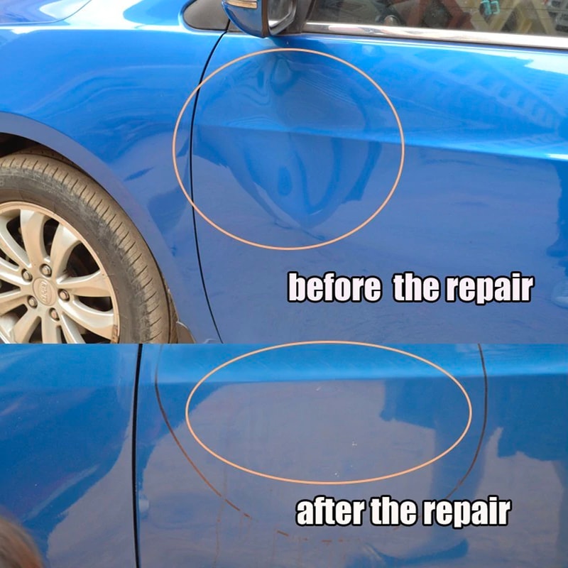 dent removal kit